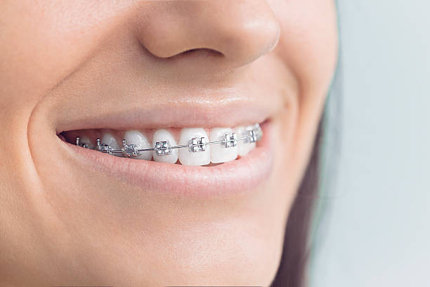 Best Invisalign and Clear Aligners  in Winterville, GA